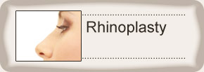 Rhinoplasty