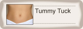Tummy Tuck